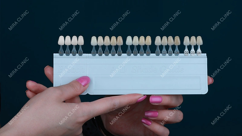 Shade selection